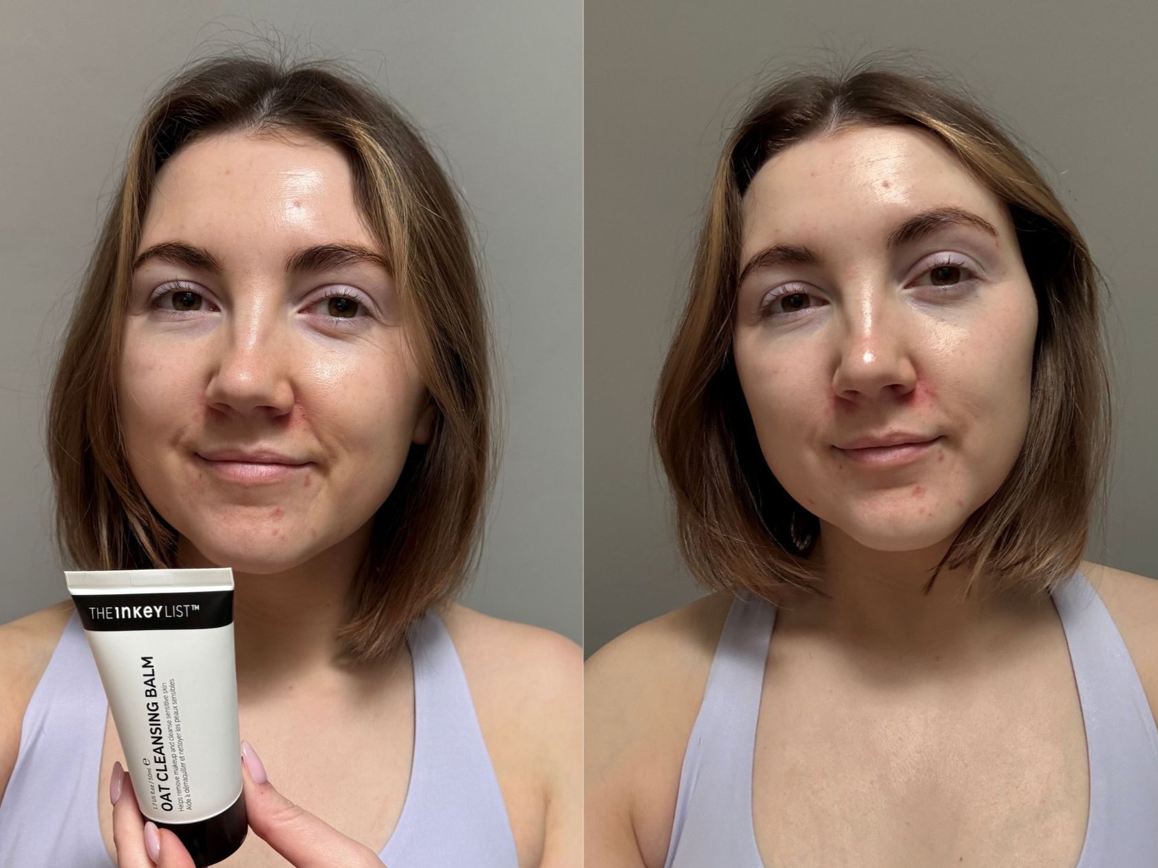 Charlotte Inkey Cleansing balm before and after Charlotte Inkey Cleansing balm before and after